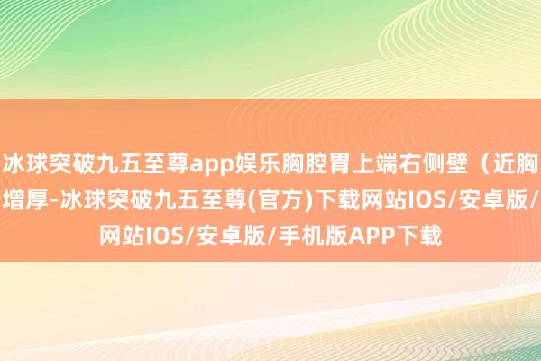 冰球突破九五至尊app娱乐胸腔胃上端右侧壁（近胸廓进口处）较着增厚-冰球突破九五至尊(官方)下载网站IOS/安卓版/手机版APP下载